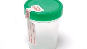 PRO ADVANTAGE® URINE SPECIMEN CONTAINERS(cs)
