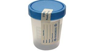 DYNAREX SPECIMEN CONTAINERS(cs)