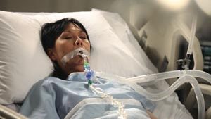 HALYARD BALLARD TRACH CARE 72(cs)