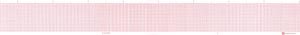 GRAPHIC CONTROLS CARDIOLOGY CHART PAPER(cs)