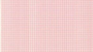 GRAPHIC CONTROLS CARDIOLOGY CHART PAPER(cs)