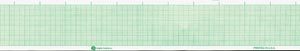 GRAPHIC CONTROLS CARDIOLOGY CHART PAPER(cs)
