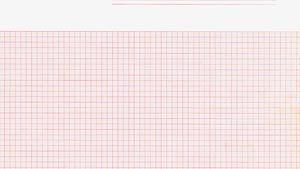 GRAPHIC CONTROLS CARDIOLOGY CHART PAPER(cs)