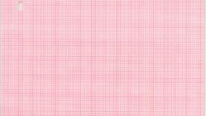 GRAPHIC CONTROLS CARDIOLOGY CHART PAPER(cs)