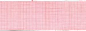 GRAPHIC CONTROLS CARDIOLOGY CHART PAPER(cs)