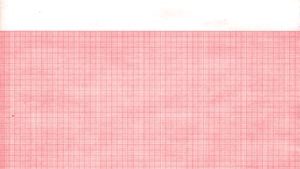 GRAPHIC CONTROLS CARDIOLOGY CHART PAPER(cs)
