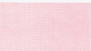 GRAPHIC CONTROLS CARDIOLOGY CHART PAPER(cs)