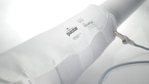 ALBA PULSTAR® PULSATILE ANTI-EMBOLISM WRAP SYSTEM(cs)